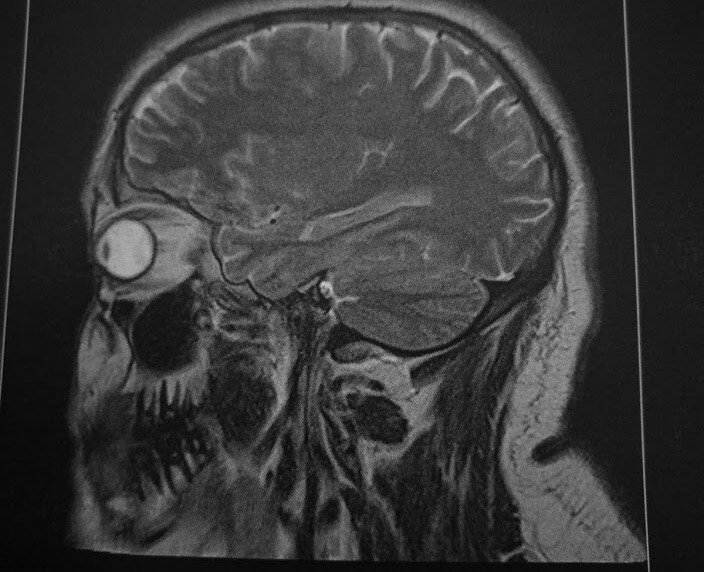 Sie müssen mich verstehen … ich hör Sie schlecht!